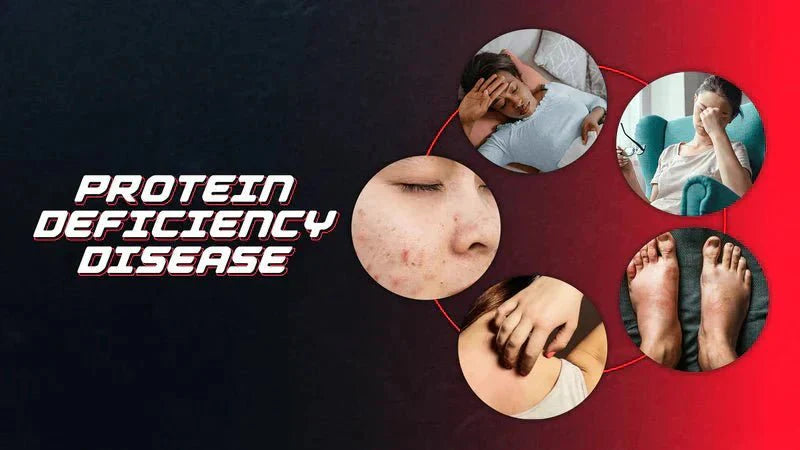 Protein Deficiency Diseases List - Proathlix