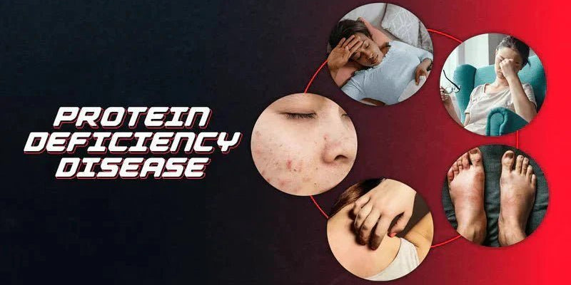 Protein Deficiency Diseases List - Proathlix